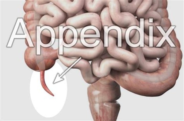 Can a person be born without an appendix