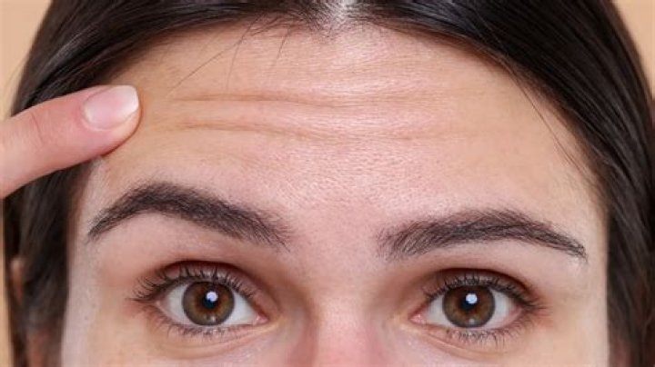 Does Khali Spraggins Have A Scar In Her Forehead? Her Disability And Wikipedia Bio