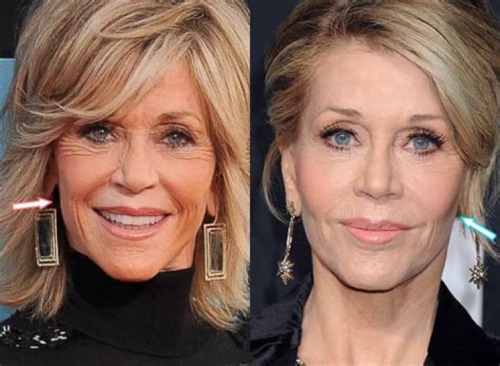 Has Jane Fonda Had Plastic Surgery? Fans Speculate On ‘Facelift’