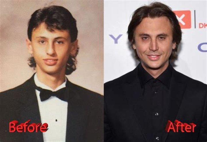 Has Jonathan Cheban Had Plastic Surgery?