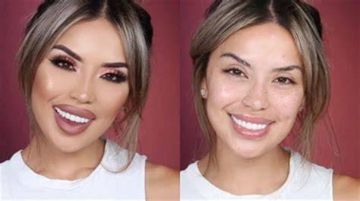 Iluvsarahii Before And After BBL Photos: Surgery Update 2023