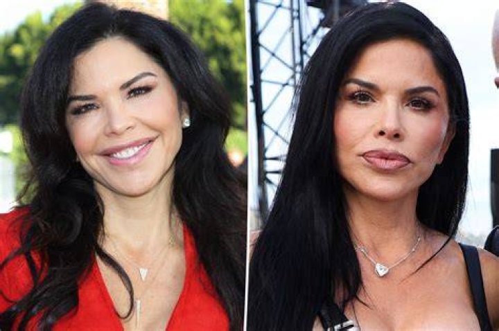 Is Lori Harvey Related To Steve Harvey? Plastic Surgery Before And After Photos Explored