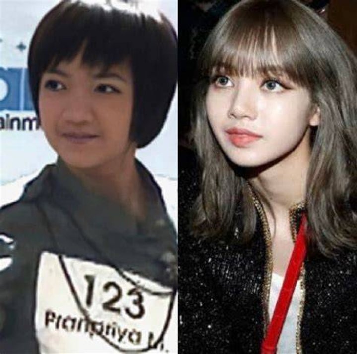 Lisa BlackPink Plastic Surgery : Before and After