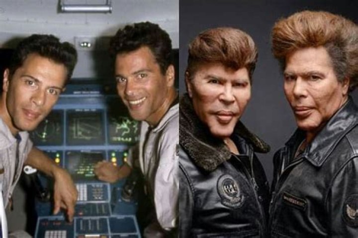 Twin Brothers Igor And Grichka Bogdanoff Before Plastic Surgery