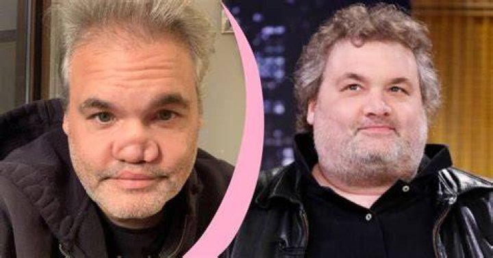 What happened to Artie Lange’s nose? Did Artie Lange get his nose fixed?
