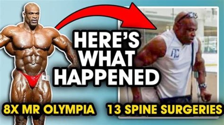 What Happened To Bodybuilder Ryley Palfi? Cause Of Death Explored