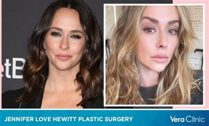 What Happened To Jennifer Love Hewitt? Everything On Her Plastic Surgery Rumors