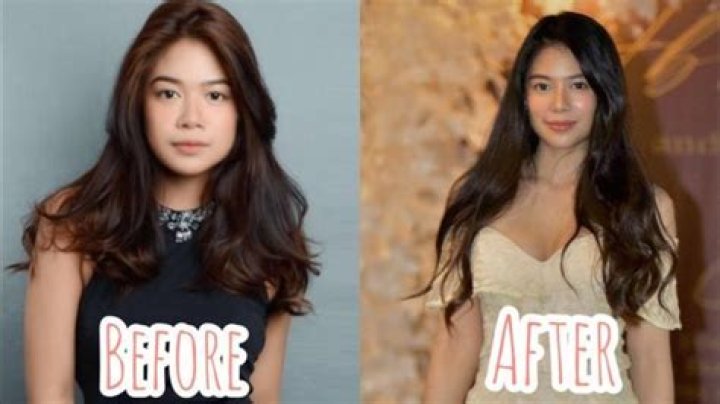Who Is Gigi De Lana Surgery Doctor? Before And After Pictures